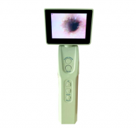 HMBS5可视化鼓膜照相仪、数字检耳镜